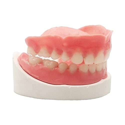 Протезиране на екстремни Пълен набор от горните и Долните изкуствени зъби за подобряване на усмивки