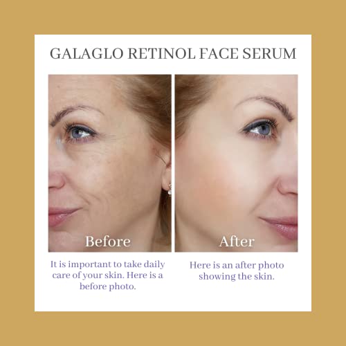 GalaGlo Retinol Серум за лице с хиалуронова киселина - Ретиноидная серум за лице за намаляване на бръчките, фините линии и тъмните